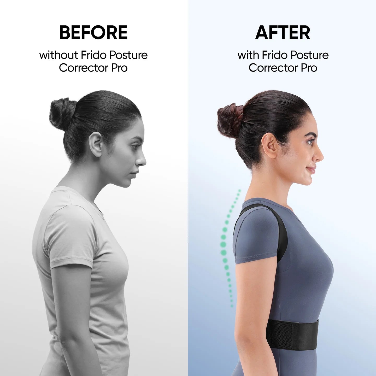 Orthotics Posture Corrector Pro